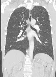 CT-onderzoeksbeeld