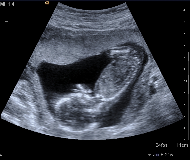 echo baby
